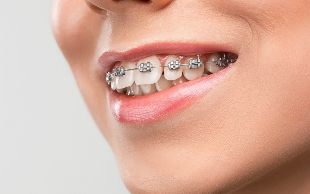 future orthodontics sydney australia perth orthodontists