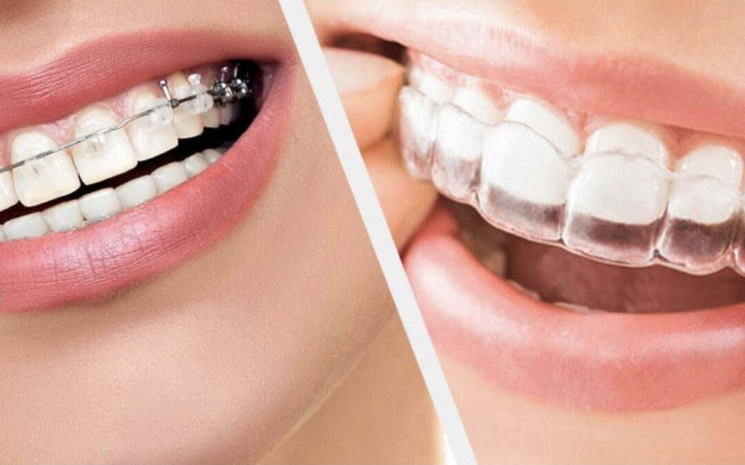 Orthodontics in Australia: Embracing the Highest Standards of Technology & Care