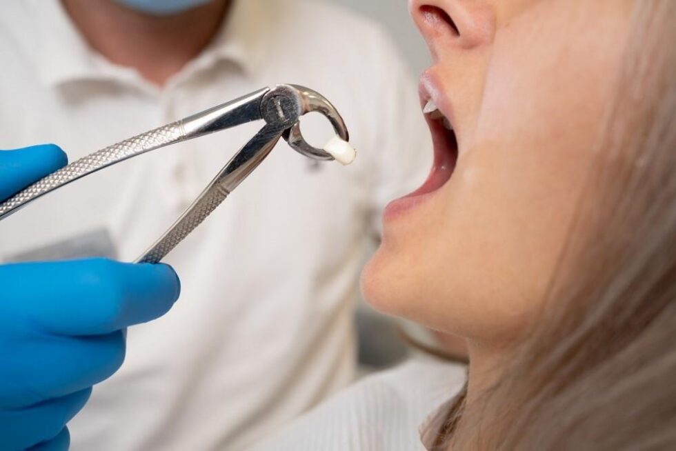 tooth-extraction-how-to-ease-the-pain-naturally