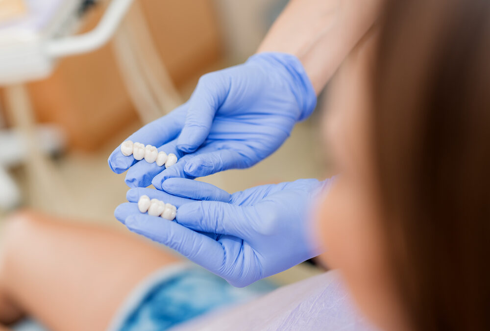 How Dental Crowns Can Save And Support Your Tooth