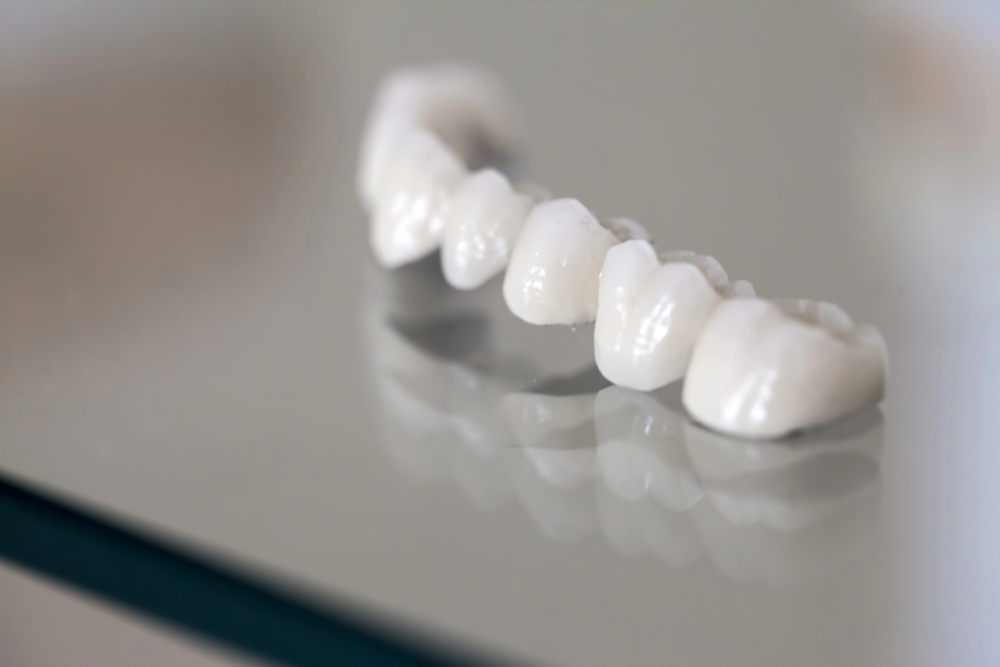 Pearly Whites: Porcelain Veneers To The Rescue