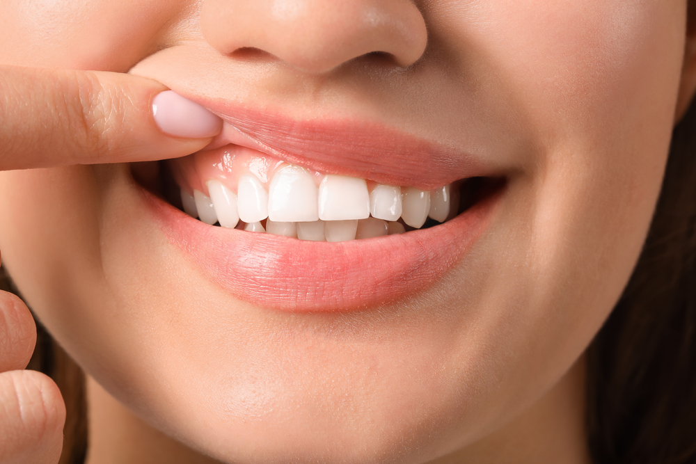 Preventing Gum Disease: Tips And Tricks For Maintaining Periodontal Health