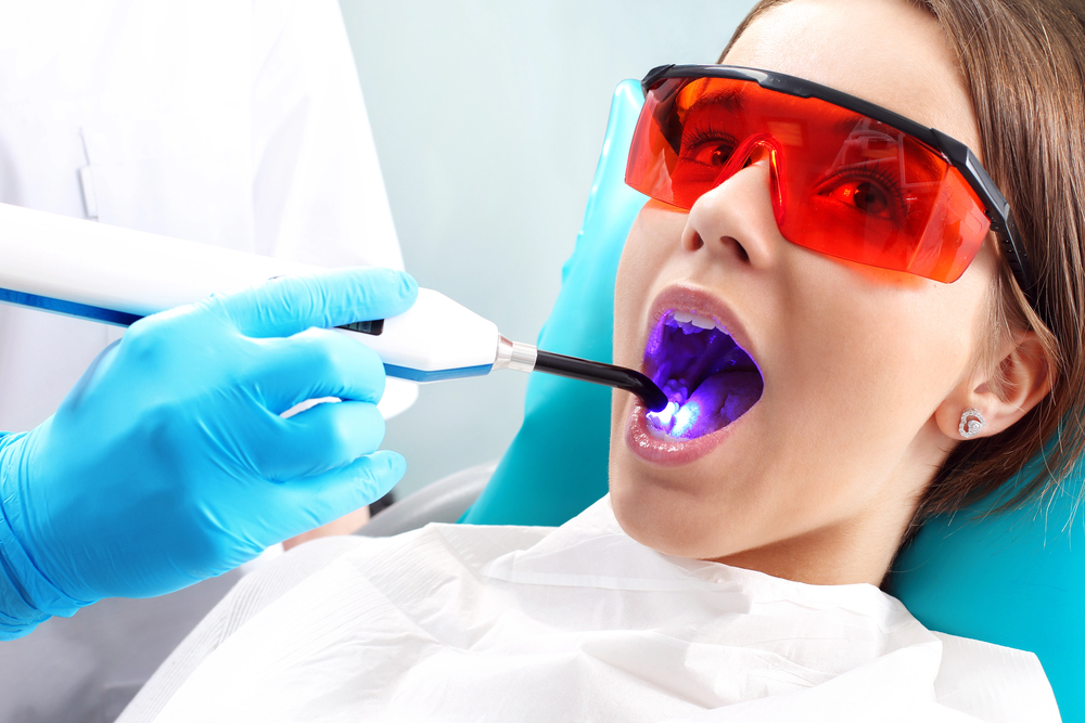Teeth Whitening