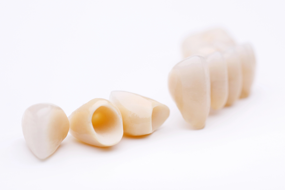 How CEREC Dental Crowns Are Redefining Dental Health Across Australia